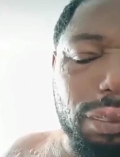 VÍDEO: Homem denuncia companheira após ataque com água fervente durante discussão