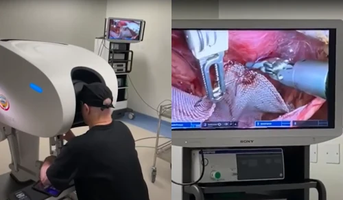 Hospital brasileiro bate recorde e realiza maior cirurgia robótica à distância do mundo