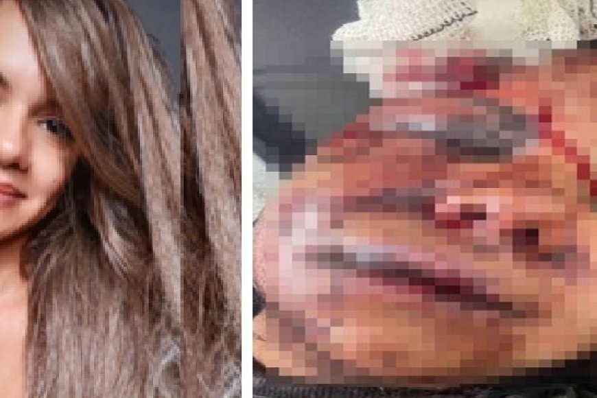 Homem que espancou namorada com 60 socos vai para cadeia pública