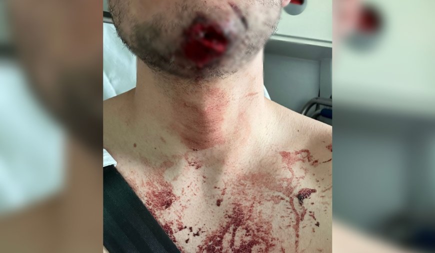 VÍDEO: Torcedor do Coritiba é atacado e agredido por grupo que supostamente queria roubar camisa de time