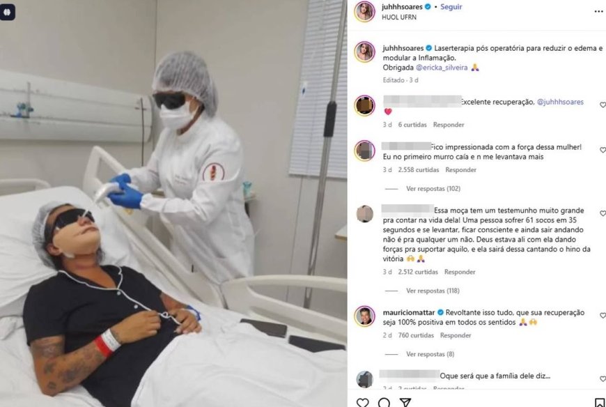 Mulher que foi agredida com 60 socos por ex-namorado mostra como ficou o rosto após cirurgia; Veja