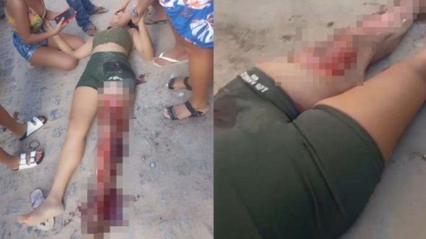 VÍDEO: Jovem sofre ferimentos graves em colisão entre moto e caçamba; Imagens Fortes