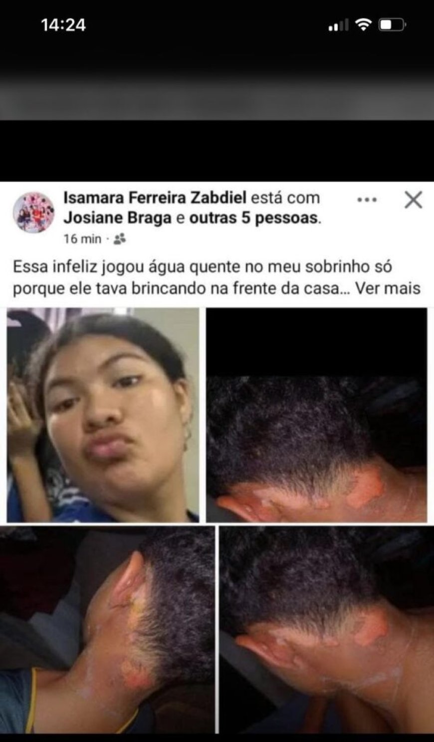 VÍDEO: Mãe se revolta com vizinha que teria jogado água fervente em criança de 9 anos e vai atrás de justiça: 'Bora, sai daí de dentro!'. VEJA VÍDEOS E IMAGENS