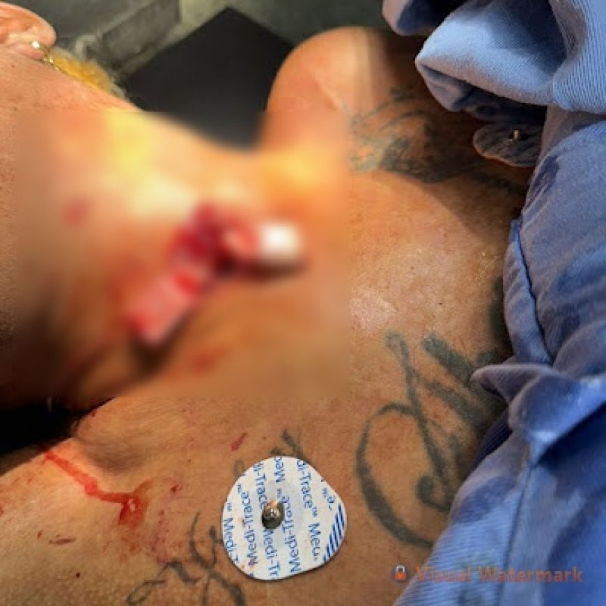 VÍDEO: Homem morre após levar chifrada de touro no pescoço em corraleja; Assista