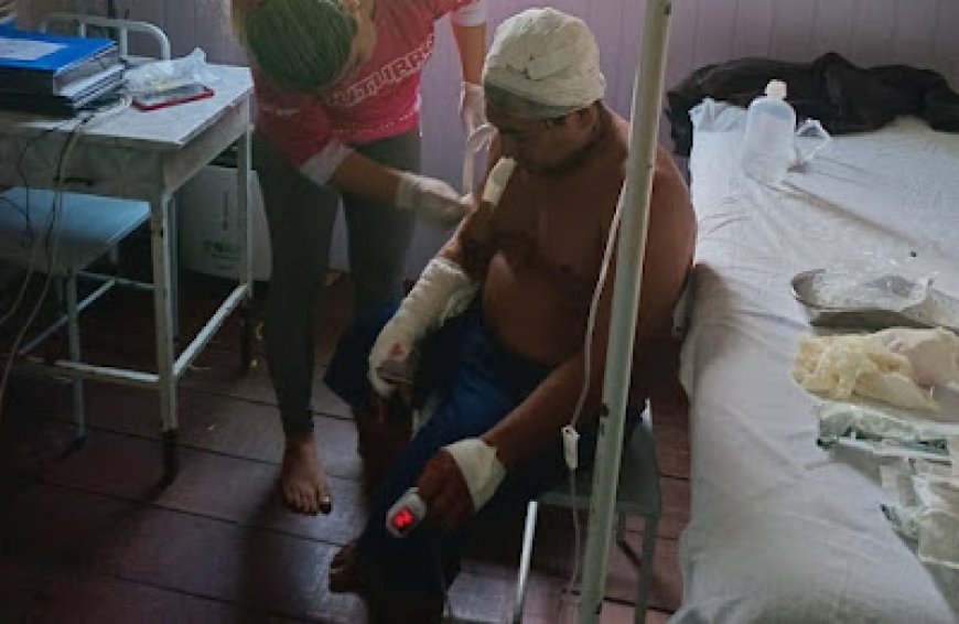 VÍDEO: Cacique sobrevive a ataque de onça no interior do Amazonas e tem ferimentos graves; Imagens Fortes