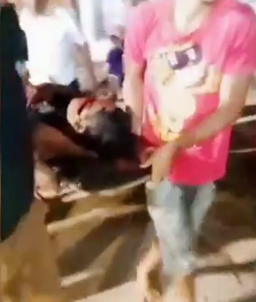 VÍDEO: Acidente com motor rabeta deixa homem gravemente ferido no rosto; Veja tragédia