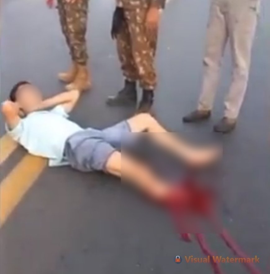 VÍDEO: Motociclista tem perna decepada em grave acidente; Imagens Fortes